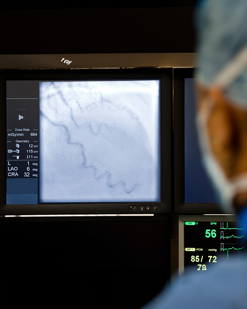 Coronary Angiogram | Cardiac Services | St Vincent's Private Hospitals